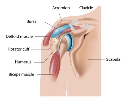 Lesion De Manguito Rotador En El Hombro Tratamiento Bupa